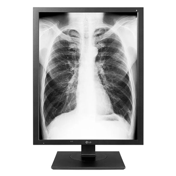 LG MONITOR DIAGNOSTICO IPS 22" (21.3) 3MP QXGA DVI DP HAS 21HK512D