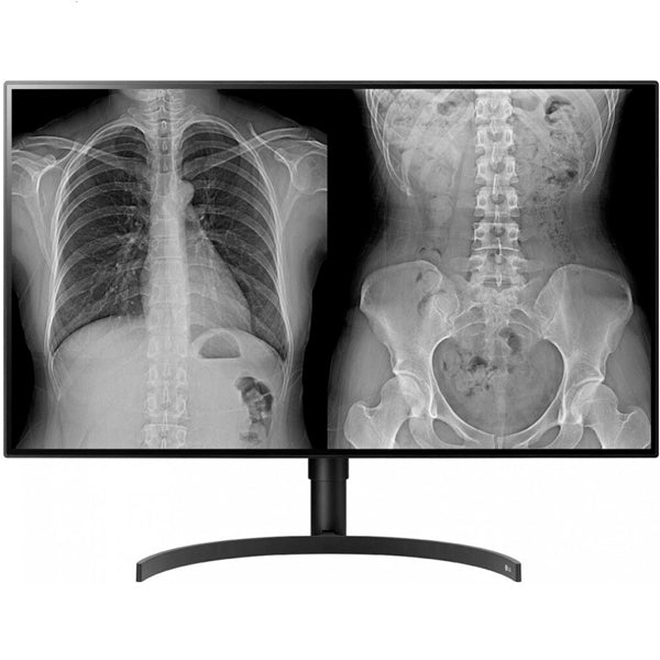 LG MONITOR DIAGNOSTICO IPS 32" (31.5) 8MP UHD 4K HDMI DP HAS PIVOT 32HL512D